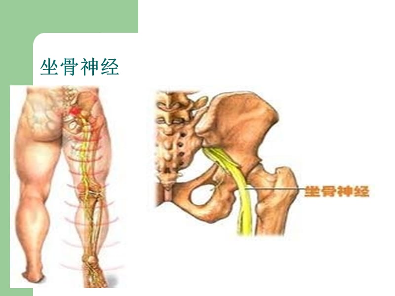 坐骨神经解剖.ppt_第2页