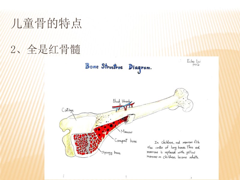 儿童骨的特点和骨折特点及预防.ppt_第3页