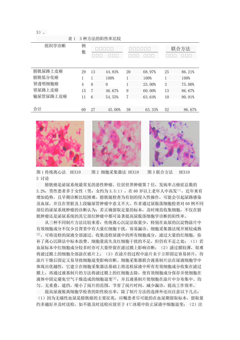 细胞采集器联合液基制片在尿液脱落细胞学中的应用.doc_第2页