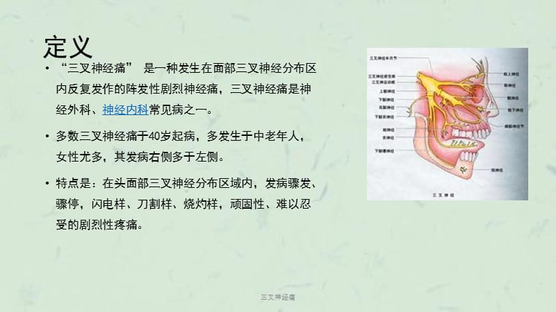 三叉神经痛课件.ppt_第2页