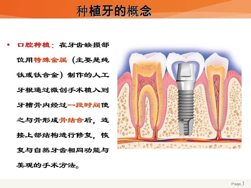 种植牙基础#行业严选.ppt_第1页