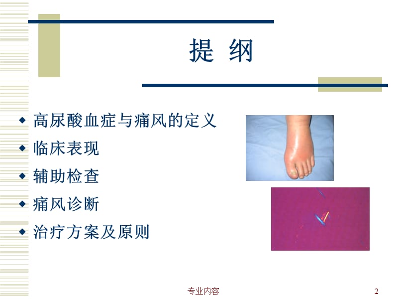 痛风的诊治ppt#荟萃材料.ppt_第2页