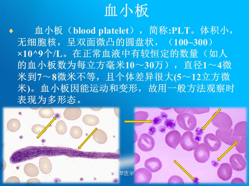 血小板功能障碍性疾病的诊断#专业医疗.ppt_第2页