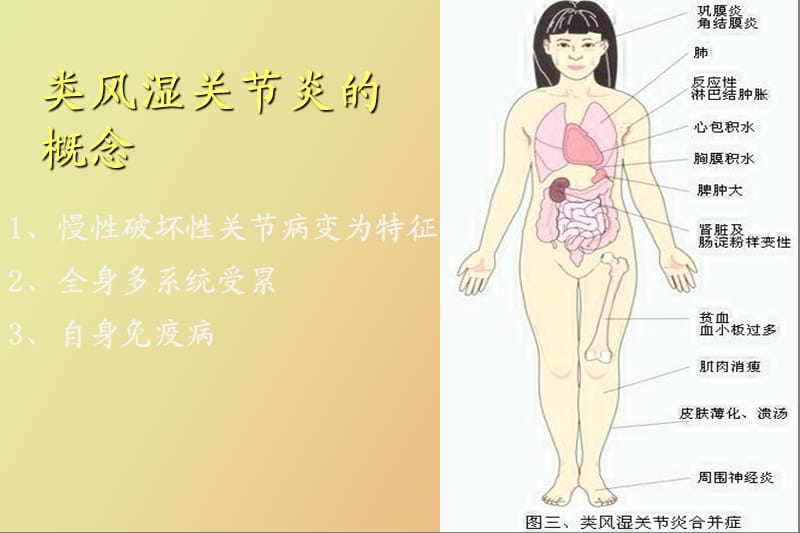 生物制剂的临床应用杨旭燕.ppt_第3页