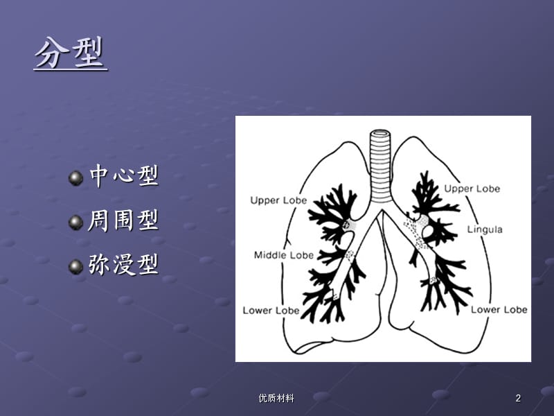 肺癌影像诊断讲课【优质借鉴】.ppt_第2页