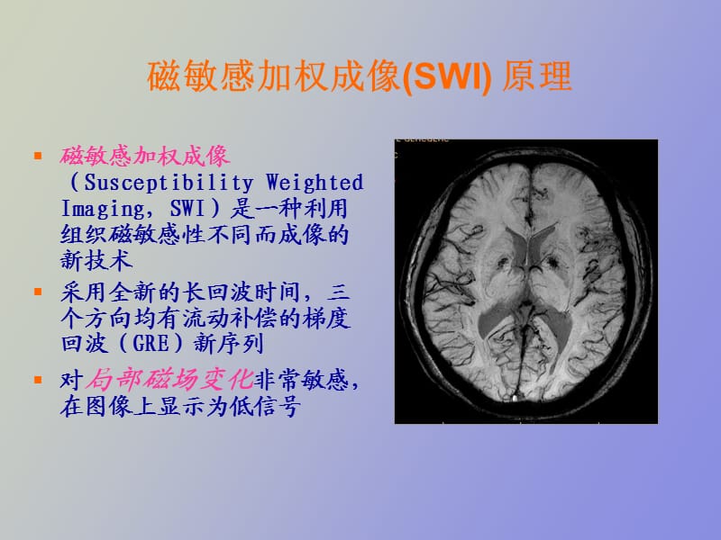 磁敏感加权成像SWI原理及临床应用.ppt_第3页