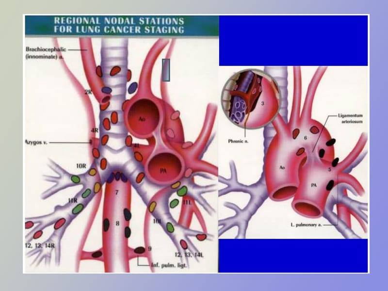 纵隔淋巴结分组.ppt_第2页