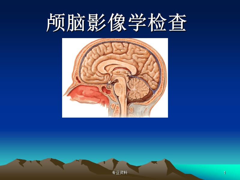 颅脑影像学检查【优质材料】.ppt_第1页