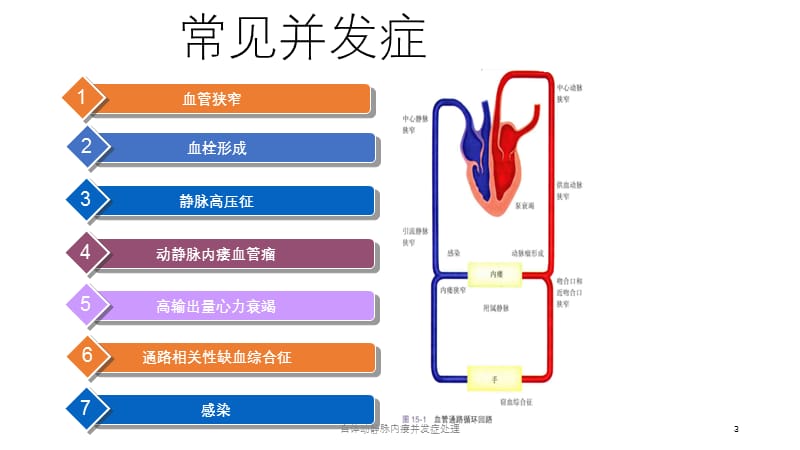 自体动静脉内瘘并发症处理课件.pptx_第3页