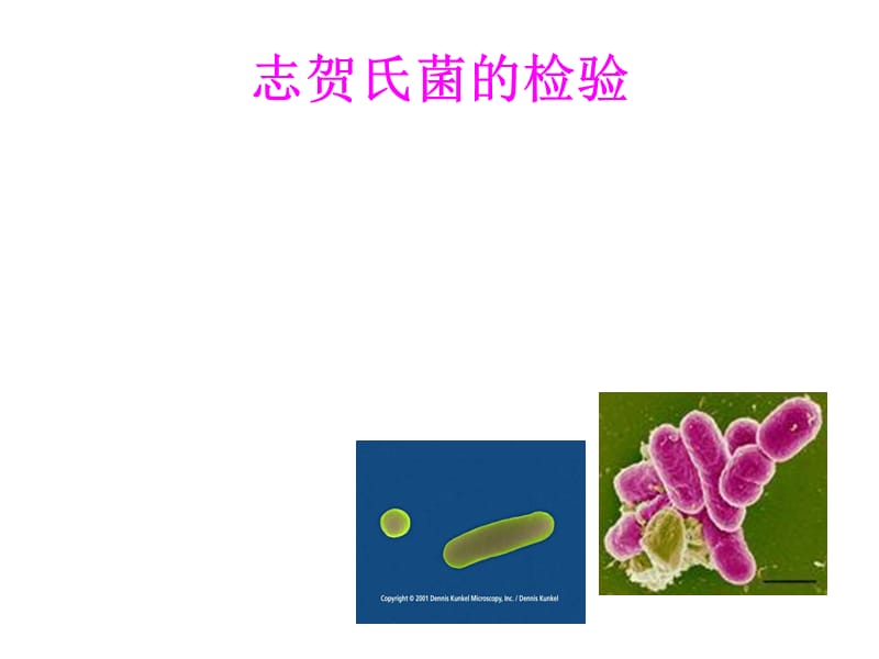 《志贺氏菌检验》PPT课件.ppt_第1页