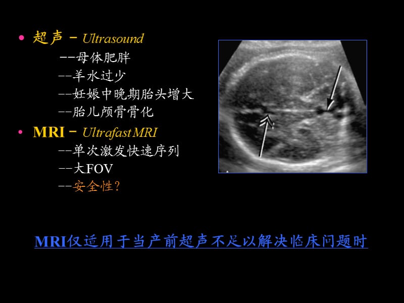 胎儿磁共振成像_胎儿头颅MRI检查.ppt_第2页