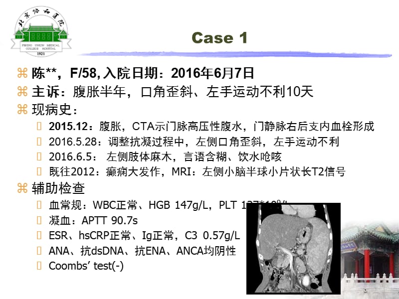 抗磷脂综合征的常见神经系统表现【专家知识】.ppt_第2页