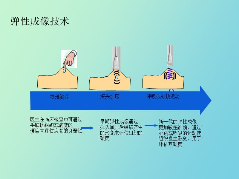 飞利浦弹性成像介绍.ppt_第2页