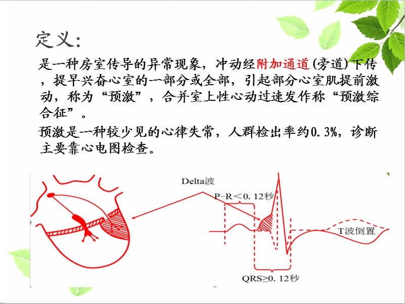 新八预激综合征.ppt_第3页