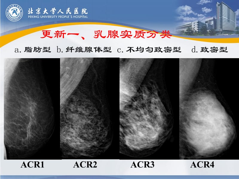 第五版BIRADS分类更新解读(乳腺钼靶).ppt_第3页