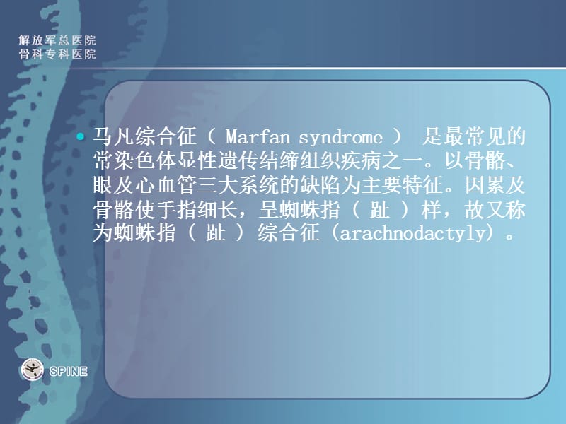 马方氏综合征-Marfansyndrome.ppt_第2页