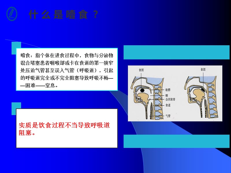 噎食的急救与防范.pptx_第3页