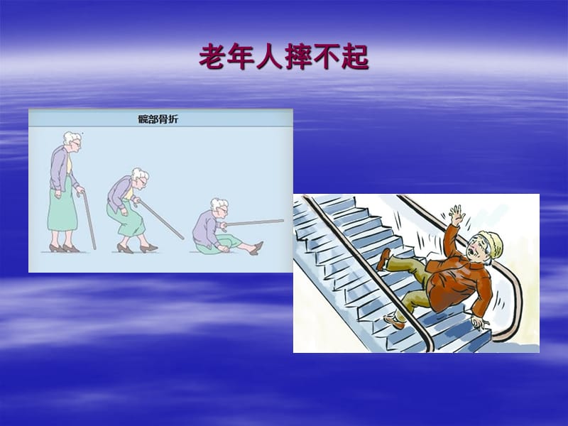 老年髋部骨折.ppt_第2页