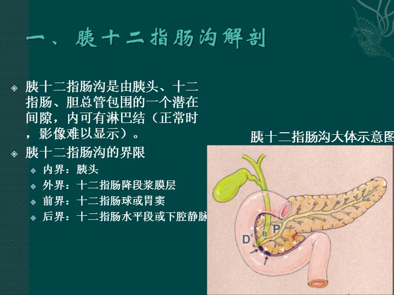 沟槽性胰腺炎.ppt_第2页