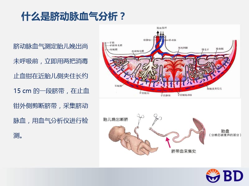 脐动脉血血气分析的临床应用.ppt_第2页