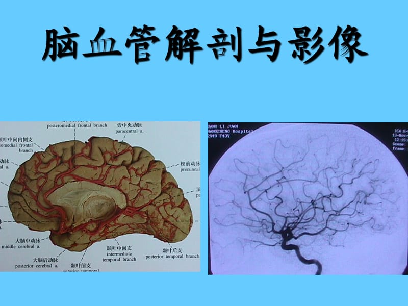 颈内动脉解剖PPT.ppt_第1页