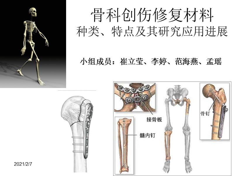 骨科创伤修复材料的种类、特点及其研究应用1.ppt_第1页