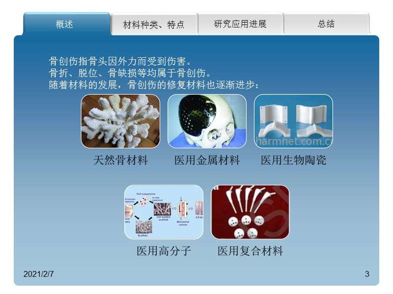 骨科创伤修复材料的种类、特点及其研究应用1.ppt_第3页