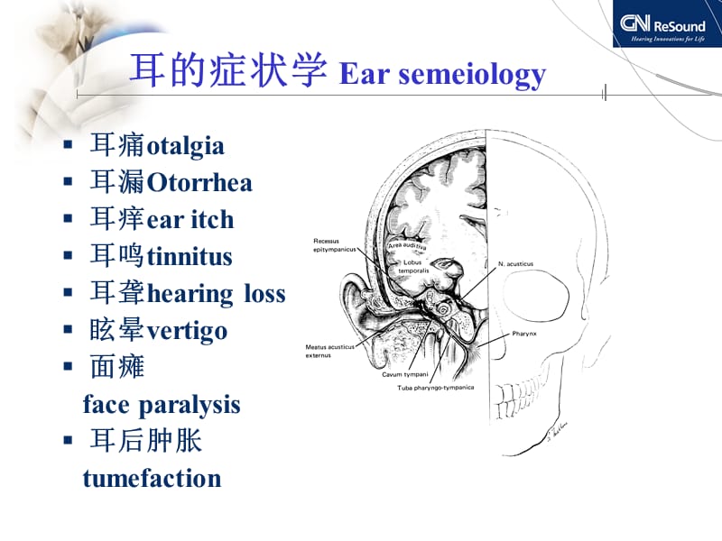 耳聋与听力图分析.ppt_第2页