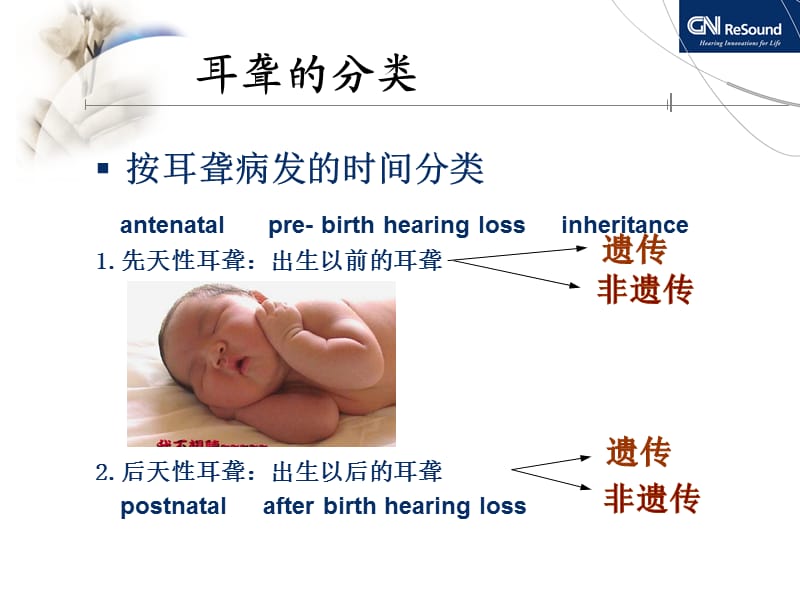 耳聋与听力图分析.ppt_第3页