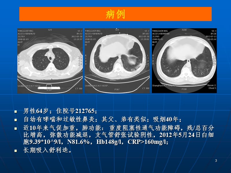 COPD诊治PPT课件.ppt_第3页