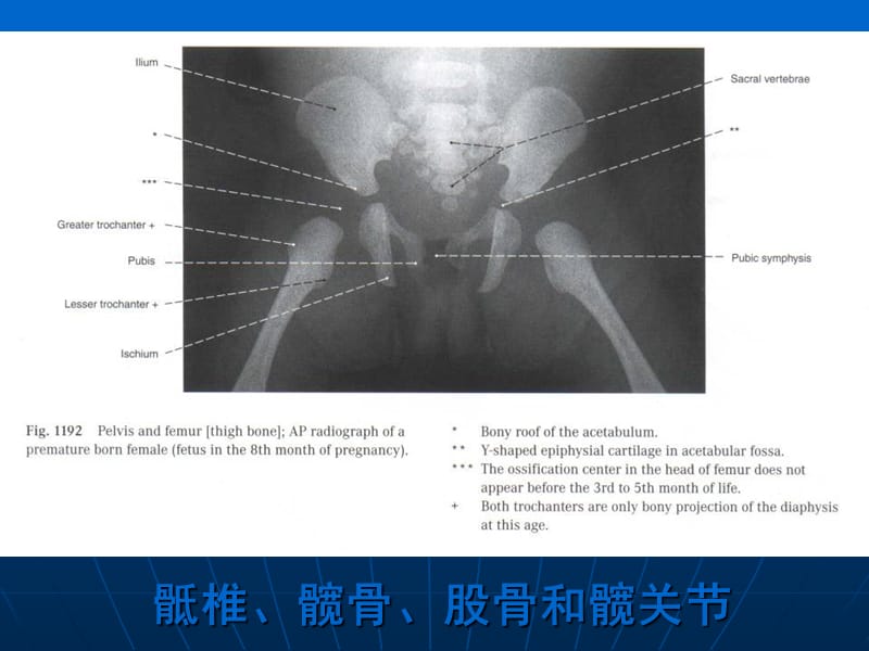 下肢的断层解剖-人体断层解剖学-课件-20.ppt_第3页