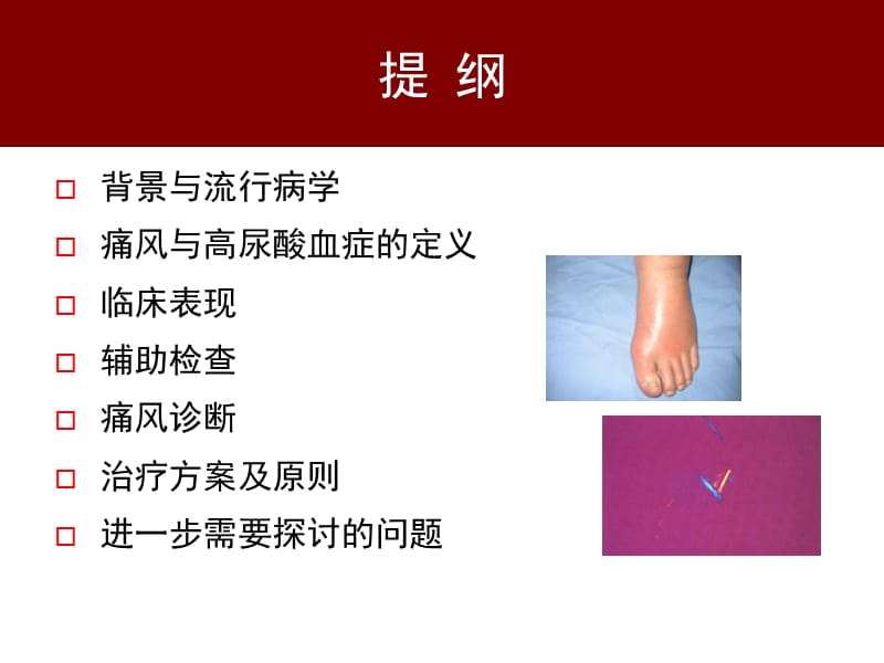 中国痛风临床诊治指南解读参考PPT.ppt_第2页