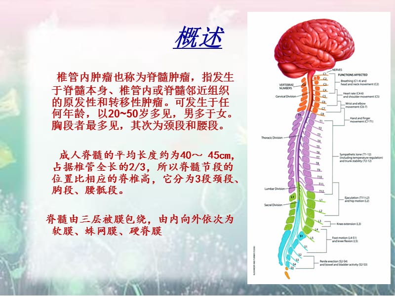 椎管内脊膜瘤的围手术期护理.ppt_第2页