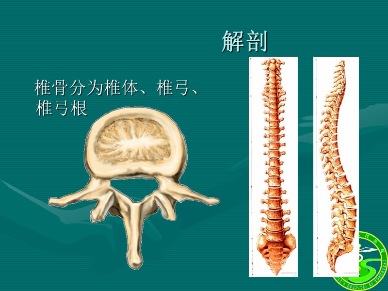 腰椎骨折.ppt_第2页