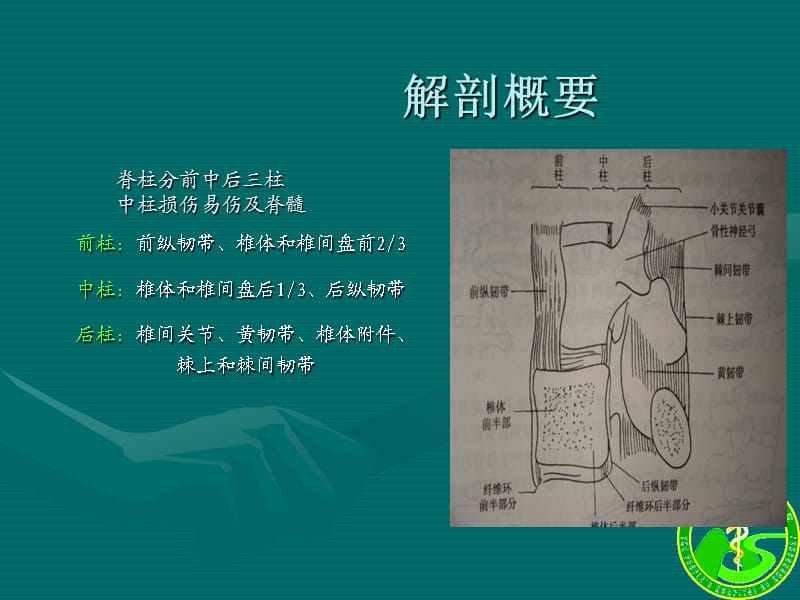 腰椎骨折.ppt_第3页