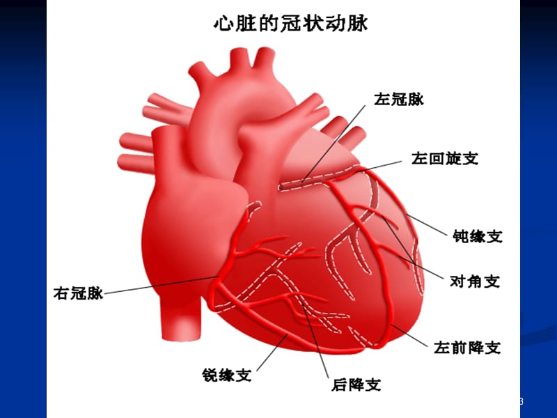 冠心病外科现状及手术参考PPT.ppt_第3页