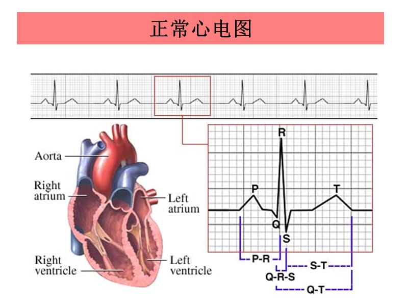 正常心电图 (1).ppt_第2页