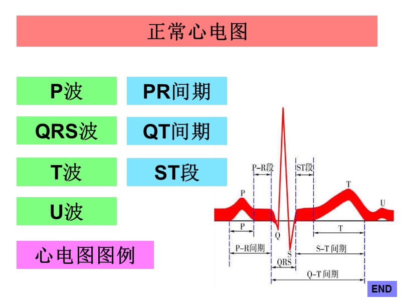 正常心电图 (1).ppt_第3页