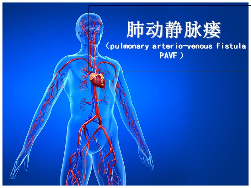 肺动静脉瘘.ppt_第1页