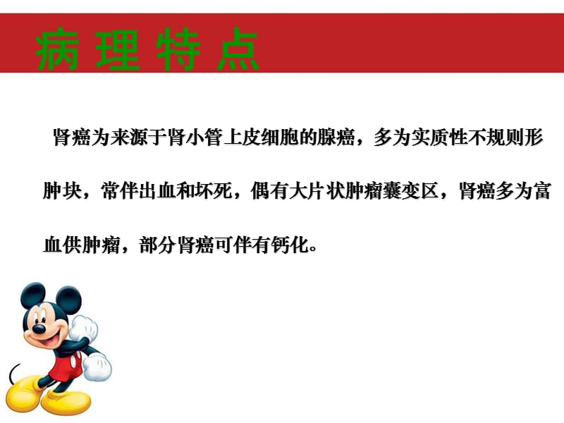 肾癌影像诊断.ppt_第2页