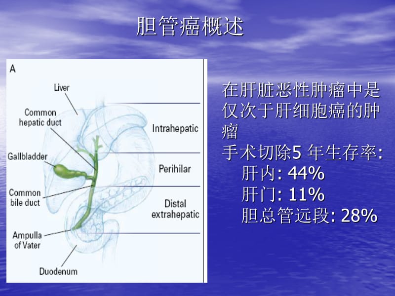 胆管癌的CT诊断.ppt_第2页