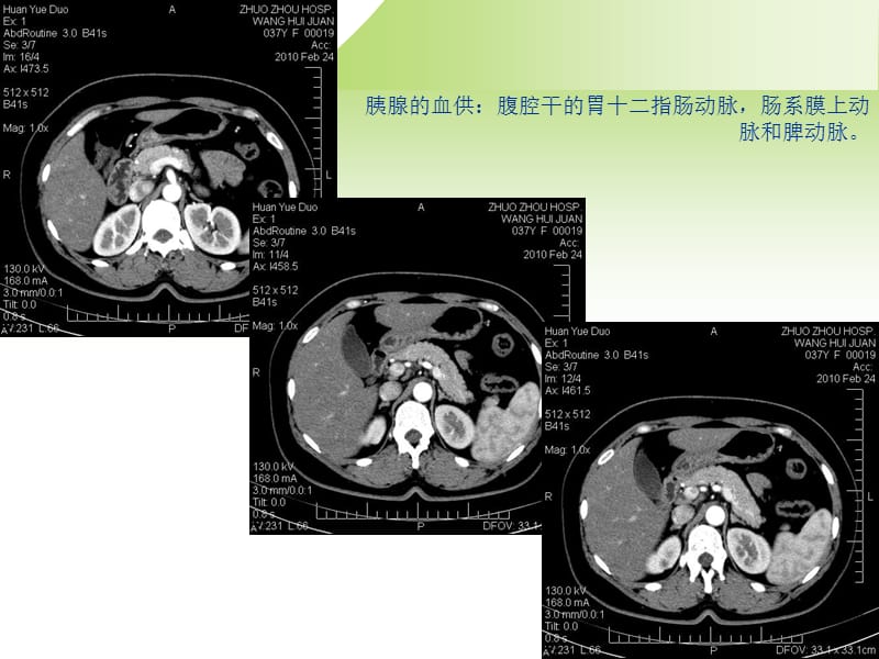 胰腺癌的影像诊断PPT课件.ppt_第3页