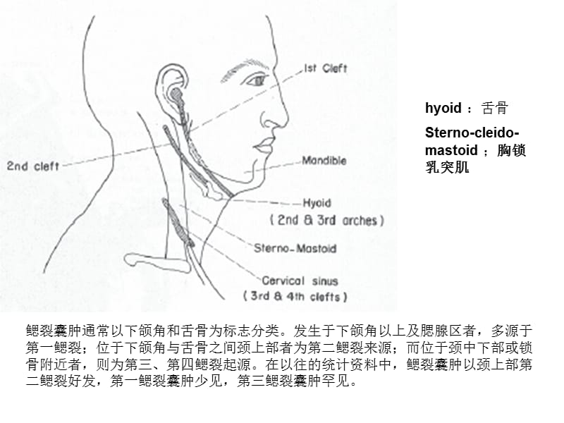 腮裂囊肿的影像诊断(1).ppt_第3页