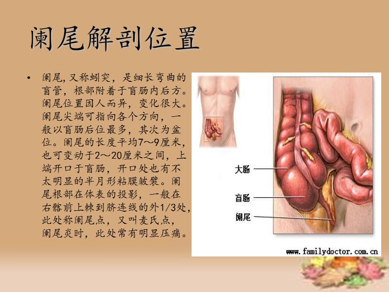 阑尾切除术的手术配合.ppt_第2页