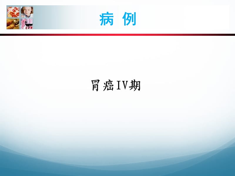 胃癌病例分享.ppt_第2页