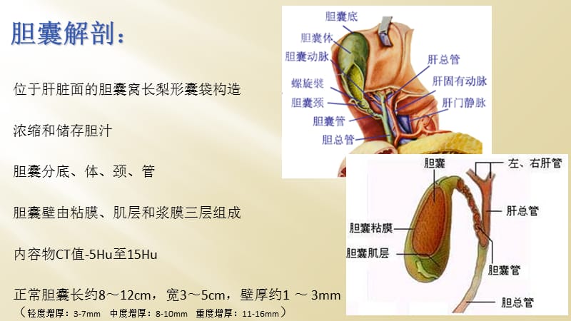 胆囊壁增厚性病变CT诊断与鉴别诊断.ppt_第2页