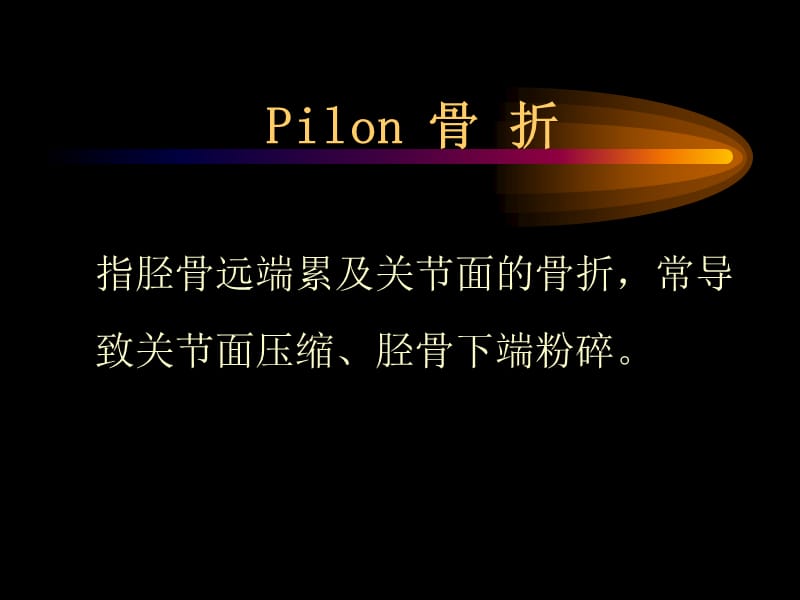 Pilon骨折外固定架.ppt_第2页