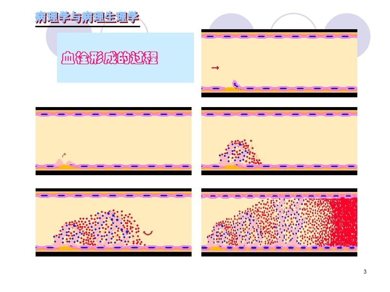 局部血液循环障碍二参考PPT.ppt_第3页