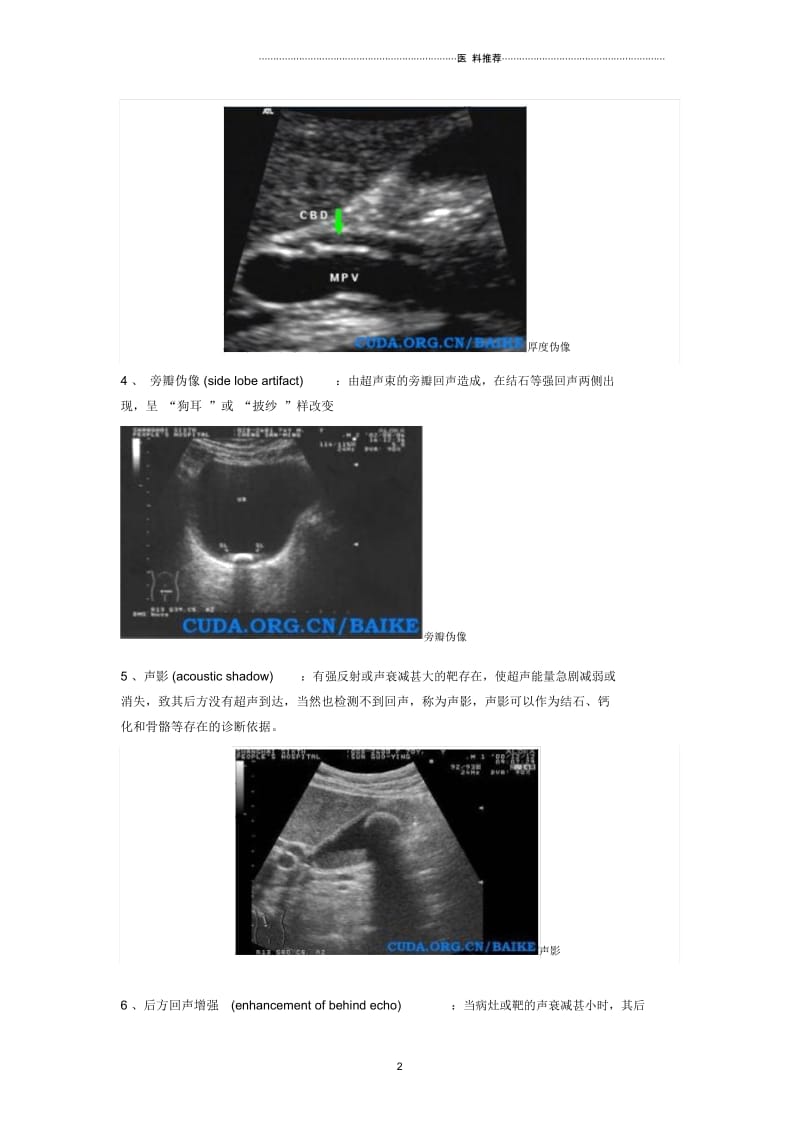 B超伪像类型.docx_第2页