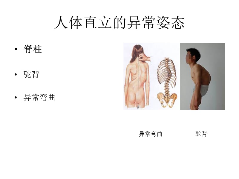 人体直立的正常姿.ppt_第3页